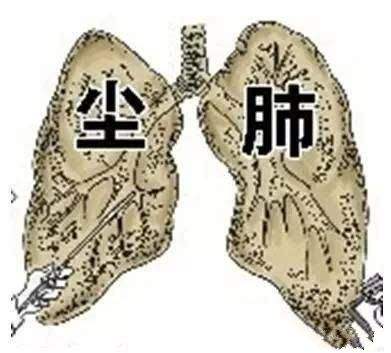 尘肺