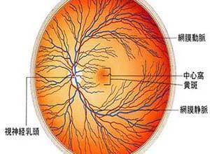 脉络膜视网膜炎