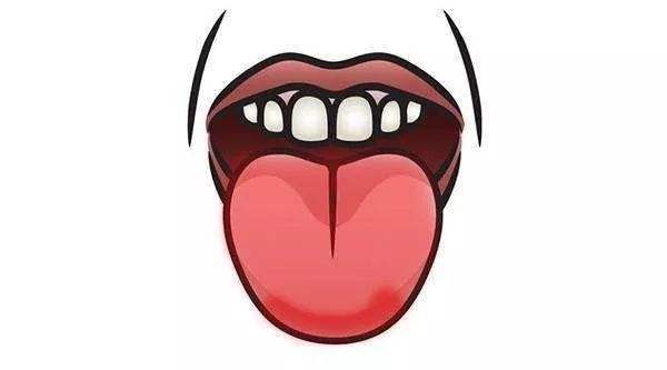 舌疾病